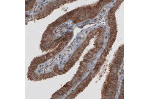 Image no. 3 for anti-Vacuolar Protein Sorting-Associated Protein 26A (VPS26A) antibody (ABIN5650310)