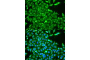 Image no. 2 for anti-Casein Kinase 1, gamma 2 (CSNK1G2) antibody (ABIN6139122)