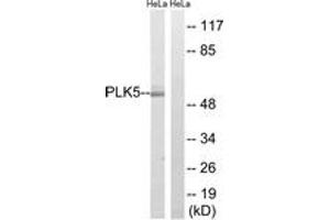 Image no. 1 for anti-Polo-Like Kinase 5 (PLK5) (AA 131-180) antibody (ABIN1535339)