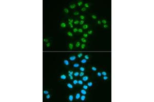 Image no. 4 for anti-BMI1 Polycomb Ring Finger Oncogene (BMI1) antibody (ABIN3020691)