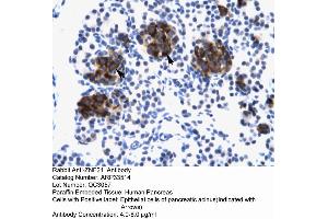 Image no. 2 for anti-Zinc Finger Protein 182 (ZNF182) (Middle Region) antibody (ABIN2777980)