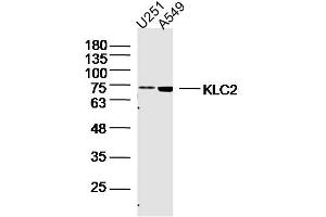 Image no. 1 for anti-Kinesin Light Chain 2 (KLC2) (AA 51-150) antibody (ABIN5675232)