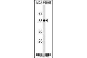 Image no. 1 for anti-Selenocysteine Lyase (SCLY) (AA 8-36), (N-Term) antibody (ABIN1539560)