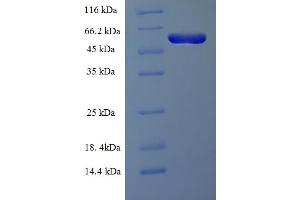 RMND5A Protein (Required For Meiotic Nuclear Division 5 Homolog A) (AA 1-385, full length) (His-SUMO Tag)