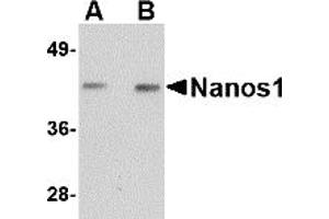 Western Blotting (WB) image for anti-Nanos Homolog 1 (NANOS1) (Middle Region) antibody (ABIN1031010)