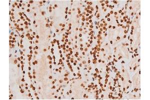 Image no. 7 for anti-REL proto-oncogene (c-Rel) (pSer503) antibody (ABIN6255382)