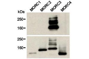 Image no. 1 for anti-MORC Family CW-Type Zinc Finger 3 (MORC3) antibody (ABIN1449250)