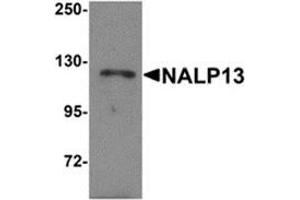 Image no. 1 for anti-NLR Family, Pyrin Domain Containing 13 (NLRP13) (N-Term) antibody (ABIN783721)