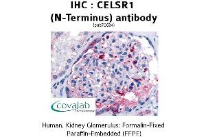 CELSR1 抗体  (Extracellular Domain, N-Term)