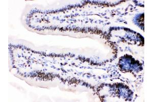 Image no. 3 for anti-Minichromosome Maintenance Complex Component 3 (MCM3) (AA 13-27), (N-Term) antibody (ABIN3044243)
