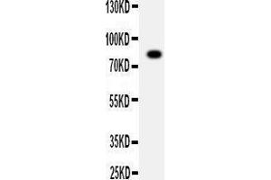 Image no. 1 for anti-ADAM Metallopeptidase Domain 2 (ADAM2) (AA 701-715), (C-Term) antibody (ABIN3042918)