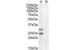 Image no. 5 for anti-Suppressor of Cytokine Signaling 1 (SOCS1) (C-Term) antibody (ABIN184575)