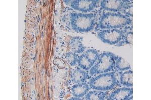 Image no. 2 for anti-WNT Inhibitory Factor 1 (WIF1) (AA 38-247) antibody (ABIN1980545)
