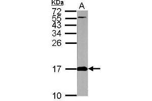 Image no. 5 for anti-Fission 1 (FIS1) (full length) antibody (ABIN2856782)