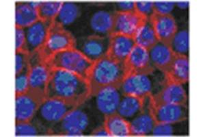 Image no. 2 for anti-Transglutaminase 1, Keratinocyte (TGM1) antibody (ABIN1109300)
