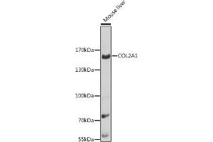 COL2A1 Antikörper  (AA 873-1072)