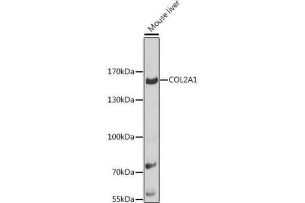 COL2A1 Antikörper  (AA 873-1072)