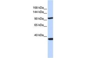 Image no. 1 for anti-Pappalysin 2 (PAPPA2) (AA 108-157) antibody (ABIN6743109)
