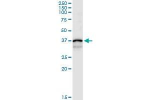 Image no. 1 for anti-Cathepsin S (CTSS) (AA 1-331) antibody (ABIN514793)