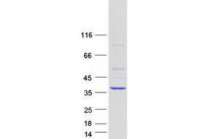 Image no. 1 for Ribonuclease H2, Subunit A (RNASEH2A) protein (Myc-DYKDDDDK Tag) (ABIN2730998)