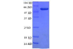 Image no. 1 for Tumor Necrosis Factor (Ligand) Superfamily, Member 10 (TNFSF10) (AA 39-281) protein (GST tag) (ABIN1047804)