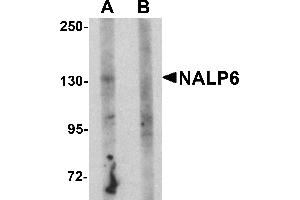 Western Blotting (WB) image for anti-NLR Family, Pyrin Domain Containing 6 (NLRP6) (N-Term) antibody (ABIN1031471)