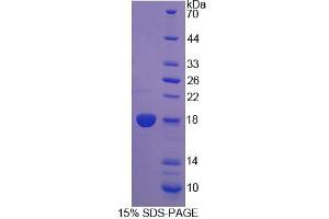 Image no. 1 for Dual Specificity Phosphatase 5 (DUSP5) (AA 1-135) protein (T7 tag,His tag) (ABIN6237141)