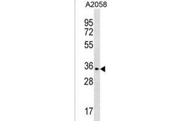 OR2T35 antibody  (C-Term)