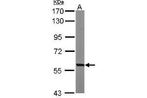 Image no. 5 for anti-phosphoglycerate Dehydrogenase (PHGDH) (N-Term) antibody (ABIN2855237)