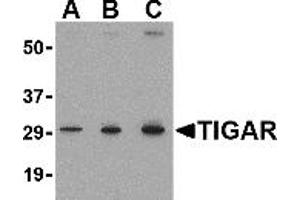 Image no. 1 for anti-TP53 induced glycolysis regulatory phosphatase (TIGAR) (Middle Region 2) antibody (ABIN1031205)