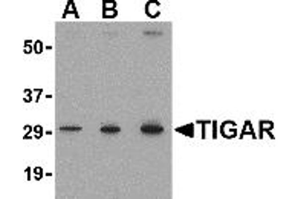 anti-TP53 induced glycolysis regulatory phosphatase (TIGAR) (Middle Region 2) antibody