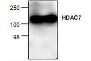 Image no. 1 for anti-Histone Deacetylase 7 (HDAC7) antibody (ABIN223302)