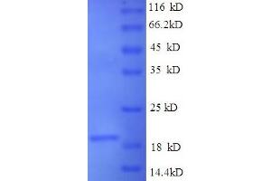 Image no. 1 for Sjogren Syndrome Antigen B (SSB) (AA 1-172), (full length) protein (His-SUMO Tag) (ABIN5711479)