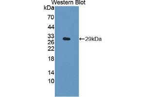 Image no. 1 for anti-DIX Domain Containing 1 (DIXDC1) (AA 485-683) antibody (ABIN5013465)