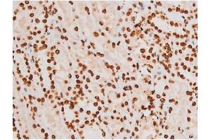 Image no. 6 for anti-REL proto-oncogene (c-Rel) (pSer503) antibody (ABIN6255382)