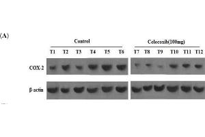 Image no. 7 for anti-Prostaglandin-Endoperoxide Synthase 2 (Prostaglandin G/H Synthase and Cyclooxygenase) (PTGS2) (AA 501-604) antibody (ABIN672471)