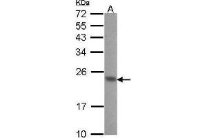 WB Image Sample (30 ug of whole cell lysate) A: A431 , 12% SDS PAGE CIB1 antibody antibody diluted at 1:1000