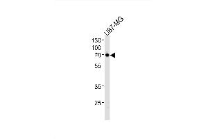 Image no. 1 for anti-Netrin 1 (NTN1) (AA 568-596), (C-Term) antibody (ABIN1881590)