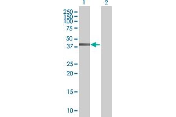 anti-Zinc Finger and BTB Domain Containing 37 (ZBTB37) (AA 1-361) antibody