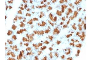 Image no. 4 for anti-Elastase 3B, Pancreatic (ELA3B) (AA 82-238) antibody (ABIN6939418)