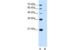 Image no. 3 for anti-arginine/serine-Rich Coiled-Coil 2 (RSRC2) (C-Term) antibody (ABIN2784458)