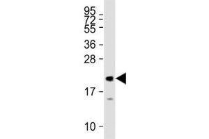 Image no. 2 for anti-Myeloid/lymphoid Or Mixed-Lineage Leukemia 2 (MLL2) (AA 4980-5009) antibody (ABIN3031895)