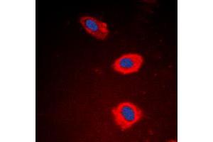 Image no. 1 for anti-5'-Nucleotidase, Cytosolic IB (NT5C1B) (Center) antibody (ABIN2706717)