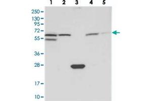 Image no. 1 for anti-Spermatogenesis Associated 18 (SPATA18) antibody (ABIN5588602)