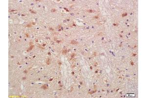 Image no. 1 for anti-Peripheral Myelin Protein 2 (PMP2) (AA 31-132) antibody (ABIN676823)