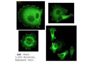 Image no. 2 for anti-Neural Precursor Cell Expressed, Developmentally Down-Regulated 9 (NEDD9) (AA 82-398) antibody (ABIN108572)