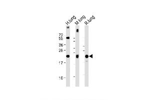 Image no. 3 for anti-Surfactant Protein C (SFTPC) (AA 1-30), (N-Term) antibody (ABIN656267)