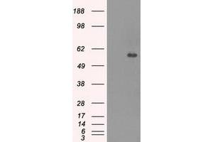 Image no. 2 for anti-Carnosine Dipeptidase 1 (Metallopeptidase M20 Family) (CNDP1) antibody (ABIN2718678)