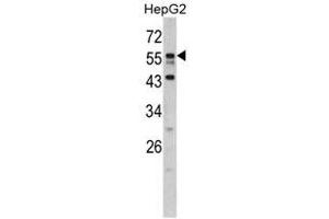 Image no. 1 for anti-Downstream Neighbor of SON (DONSON) (N-Term) antibody (ABIN452922)