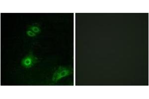 Image no. 2 for anti-Olfactory Receptor, Family 4, Subfamily A, Member 16 (OR4A16) (AA 261-310) antibody (ABIN1535897)